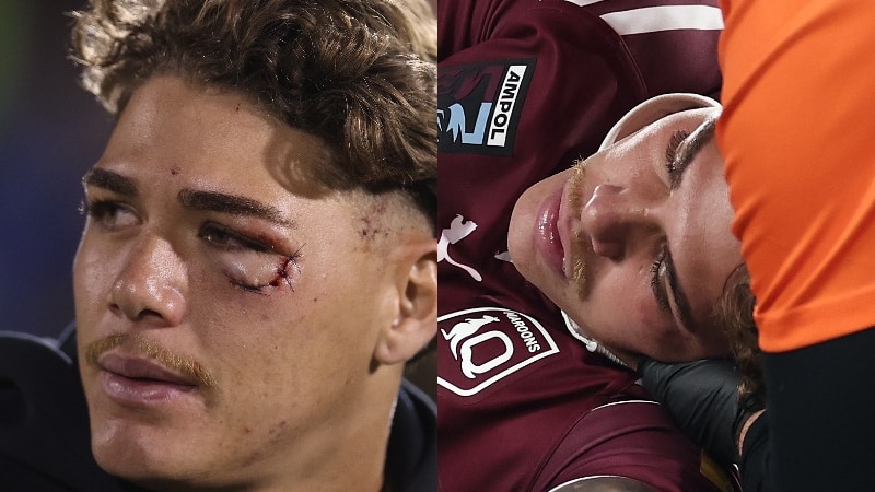 Composite image of Reece Walsh with an eye injury and knocked out.