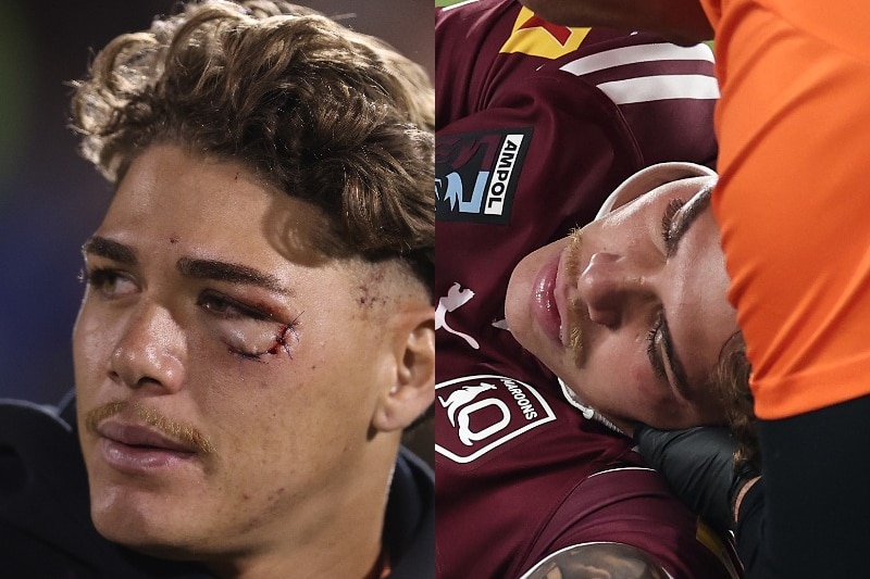 Composite image of Reece Walsh with an eye injury and knocked out.