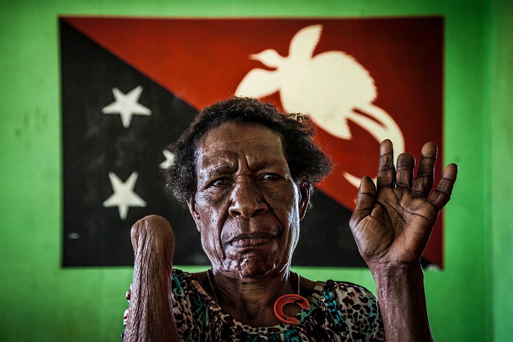 Russian photographer documents PNG abuse - ABC News