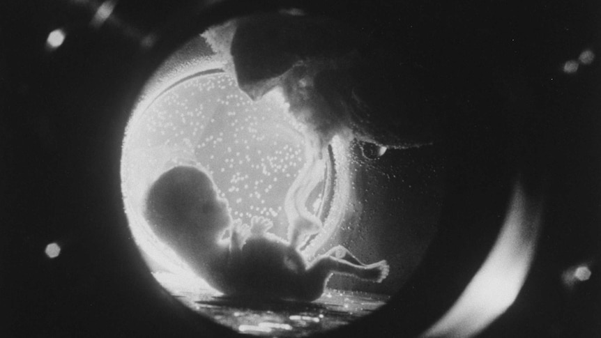A view of fetus in an artificial womb.