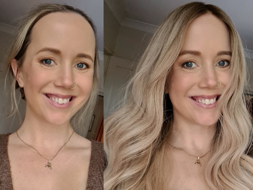 Before and after of Kellie Scott wearing her wig