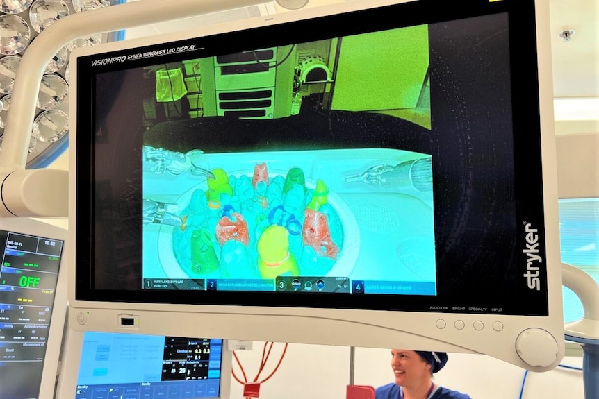 A screen showing an image of surgery simulation.