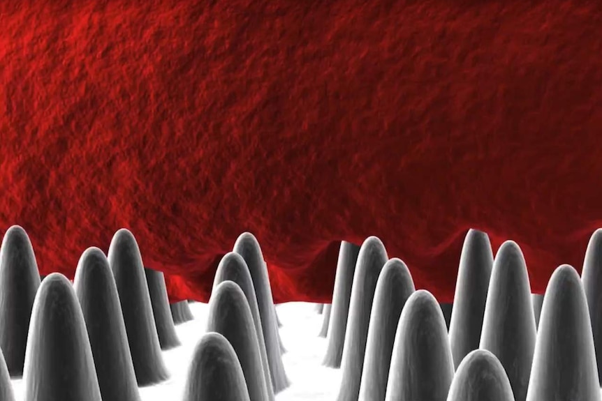A 3D simulation of the tiny pillars that kill bacteria.