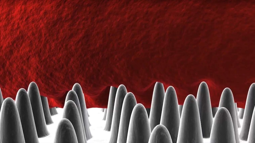 A 3D simulation of the tiny pillars that kill bacteria.