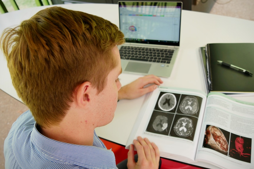 A young man looks at a text book containing images of brain scans