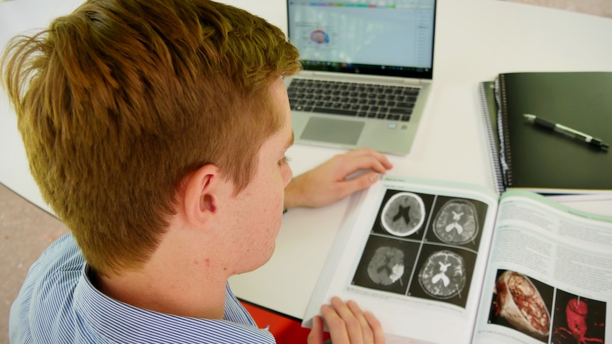 A young man looks at a text book containing images of brain scans