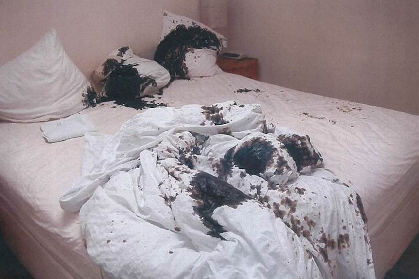 The acid, thrown by Berlinah Wallace on her ex-boyfriend Mark van Dongen, burnt the white bed sheets black.
