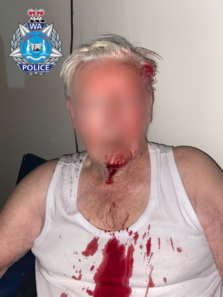 An elderly man with his face blurred, with blood on his white singlet.