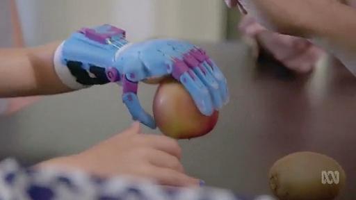 Catalyst: Affordable prosthetics made with 3D printing - ABC Education