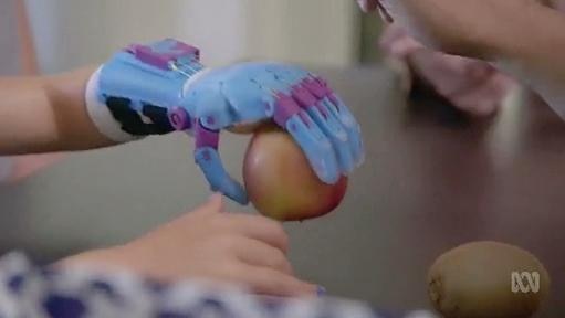 A prosthetic hand holds an apple