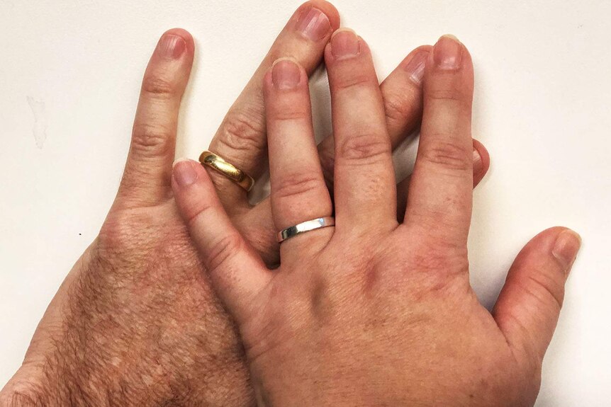 A man and woman's hands crossed, both wearing wedding rings