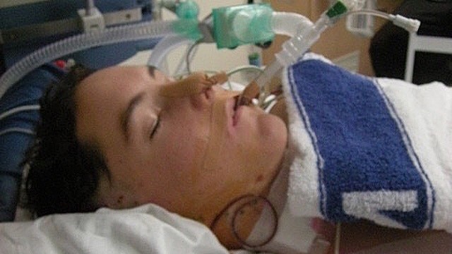 A brunette man laying in a hospital bed with a clear plastic pipe coming out of his mouth