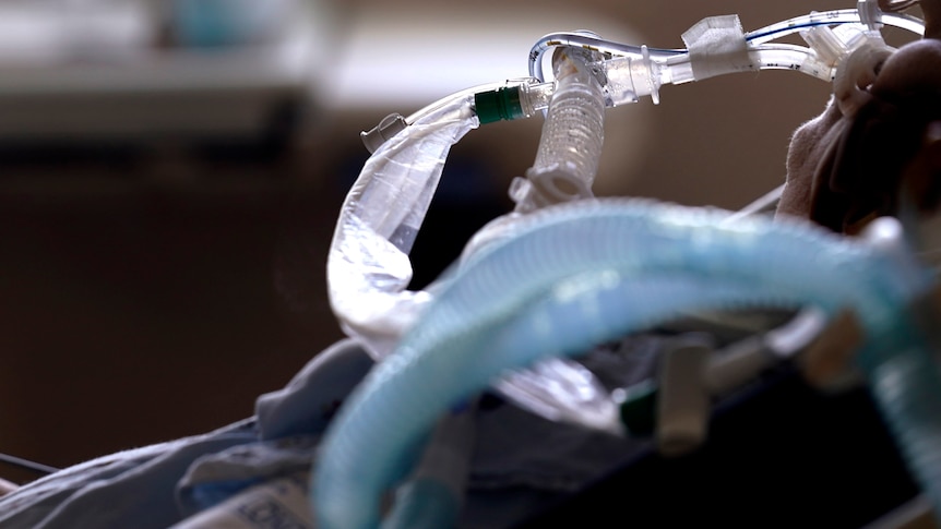A patient with COVID-19 on breathing support lies in a bed in an intensive care unit.