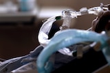 A patient with COVID-19 on breathing support lies in a bed in an intensive care unit.