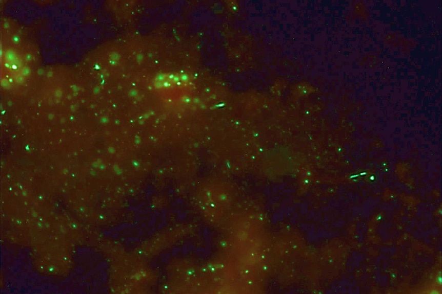 Image of a fluorescent antibody test performed on brain tissue demonstrating presence of lyssavirus antigen. August 27, 2014.