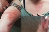 A composite image of three photos of injuries to an arm, a chest and an ear.