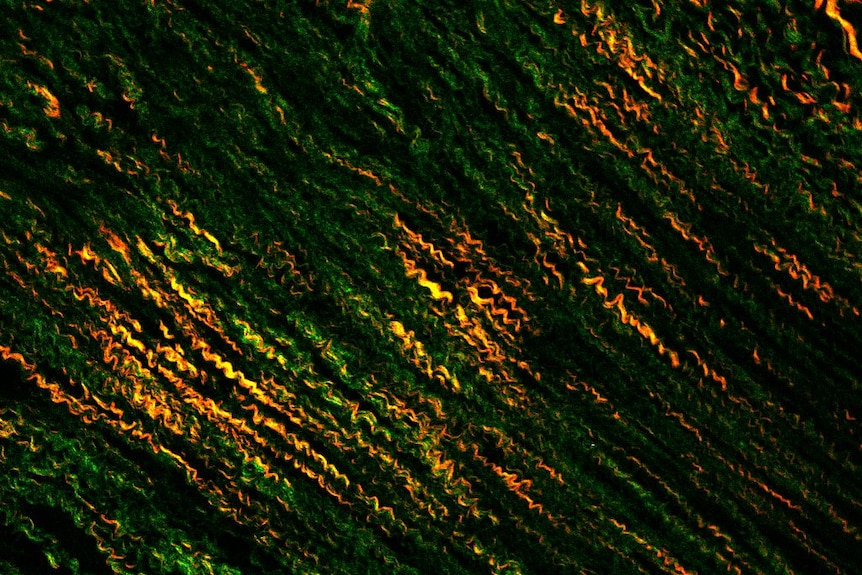 Squiggly yellow, orange and green lines on a black background