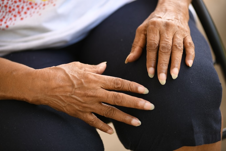 Eileen Cummings' hands rest on her knees