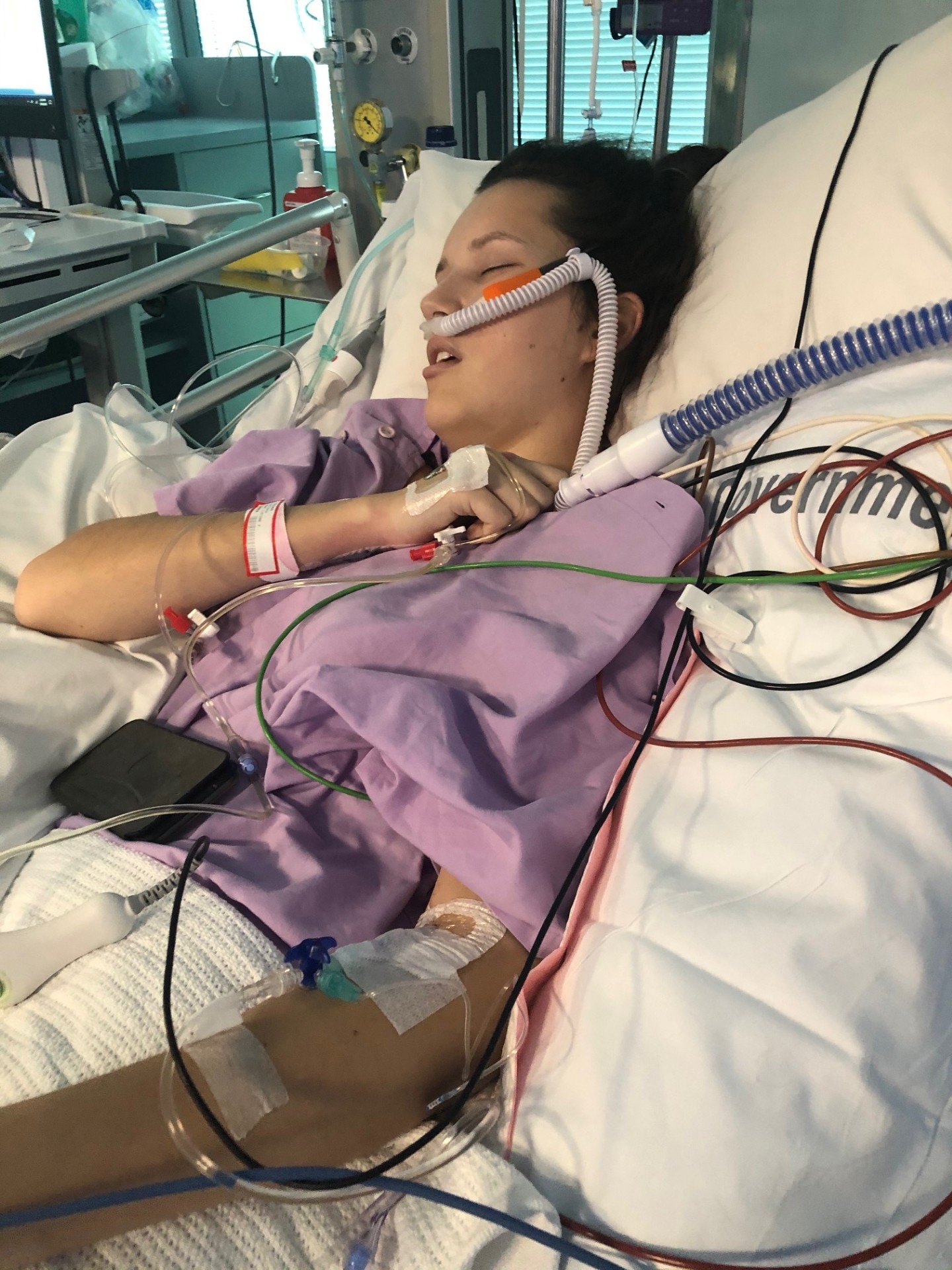 A young woman in a hospital bed with lots of tubes attached to her.