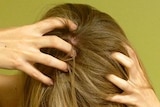 Head lice can be very annoying