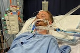 A man lying ventilated and unconscious on a hospital bed.