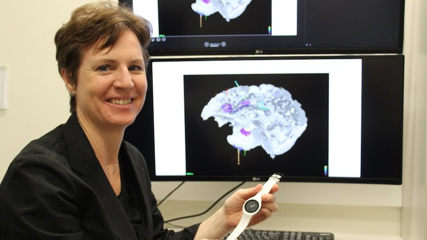  Professor Aileen McGonigal holding a smartwatch in front of a brain scan. 