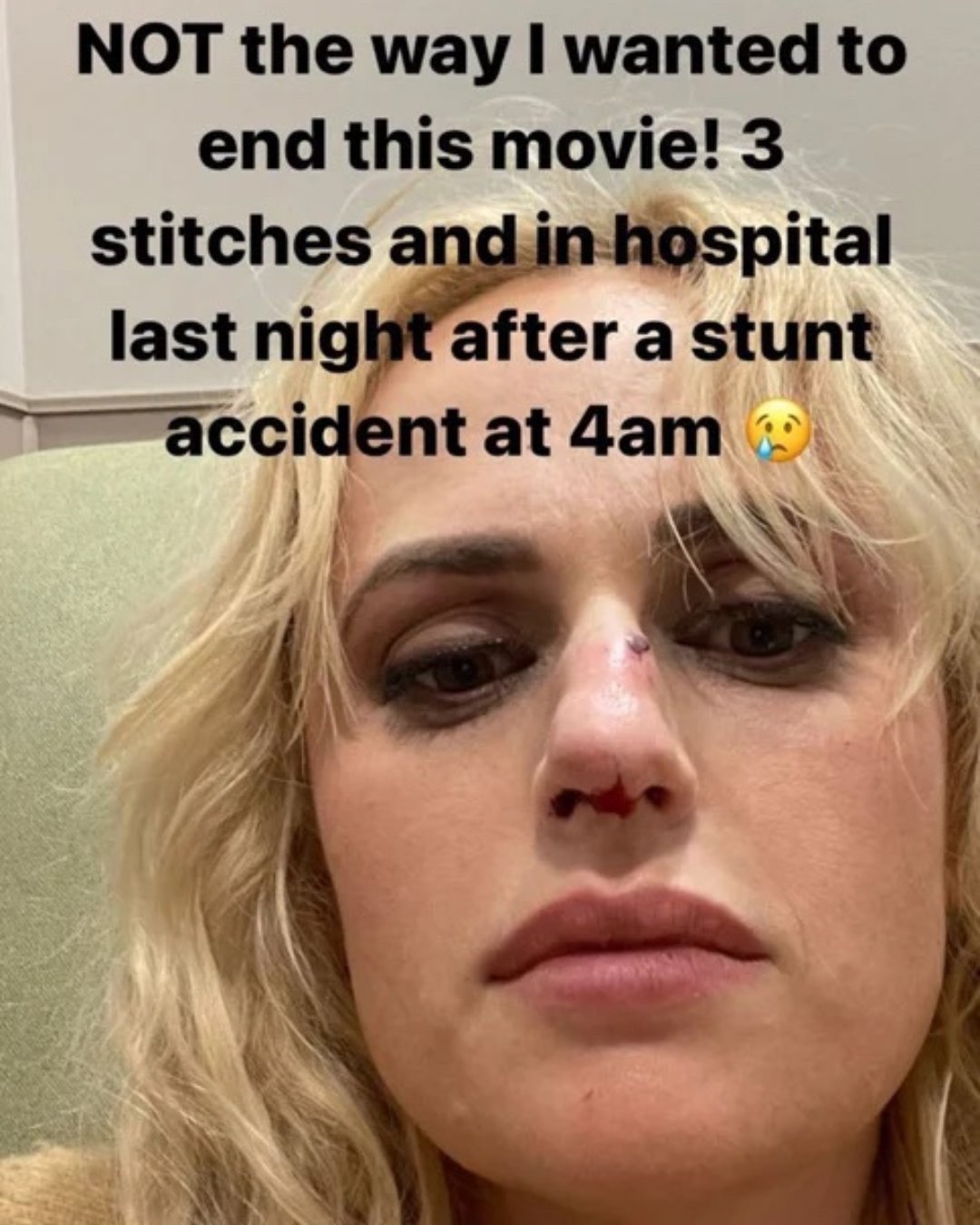 A screenshot of a social media post shows a blonde woman with injuries to her nose. 