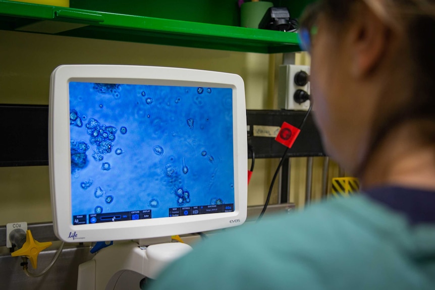 Looking over the shoulder of a scientist who is looking at a  blue screen with big blobs of pig cells on it.