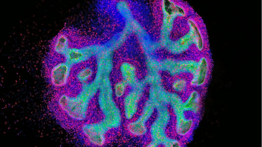 Neon-coloured image of an early stage lung being grown in the laboratory
