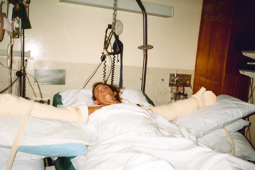 Phil Britten lying in a hospital bed with his arms bandaged and tubes up his nose after being injured in the Bali bombings
