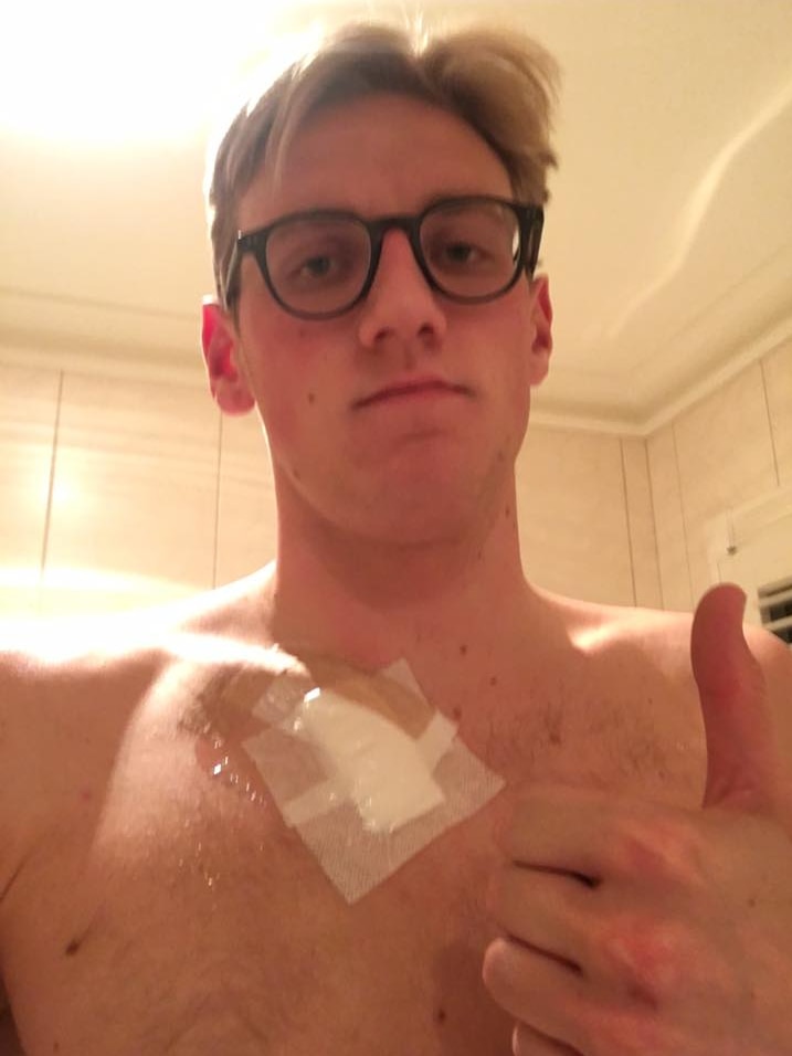 Mack Horton after having a mole removed from his chest.