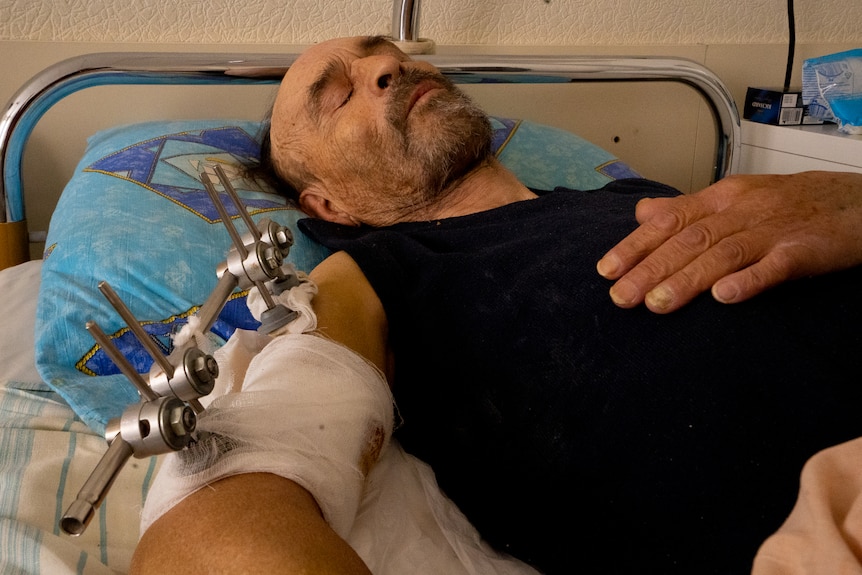 An injured man looks pained while lying in a hospital bed.
