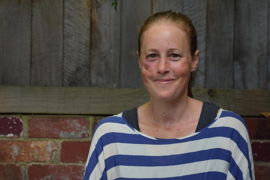 Woman sits smiling, paling fence behind her.