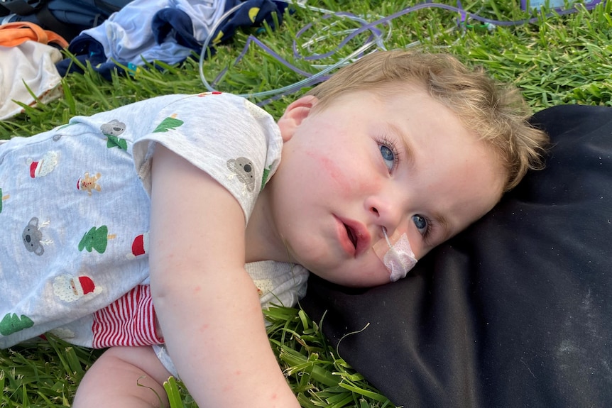 A baby wearing a Christmas shirt lying on the grass. He has medical tape on his cheek and blue eyes