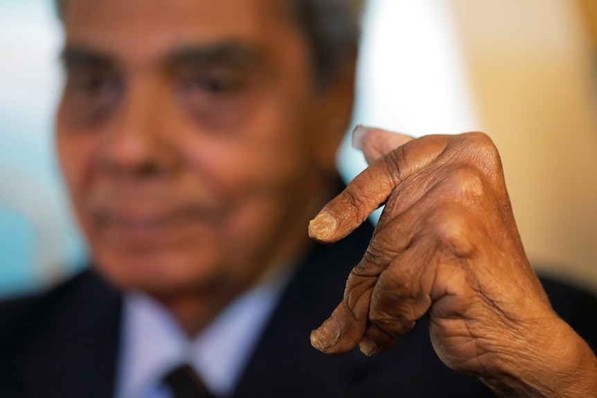 Close-up of man with freshly cut nails.