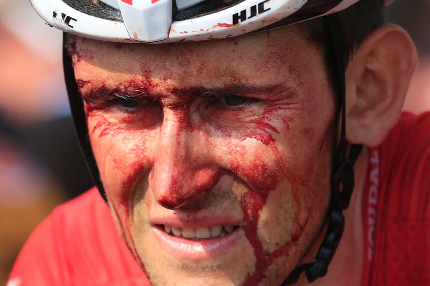 Belgium's Tiesj Benoot crosses the line with blood on his face after Tour de France stage four.