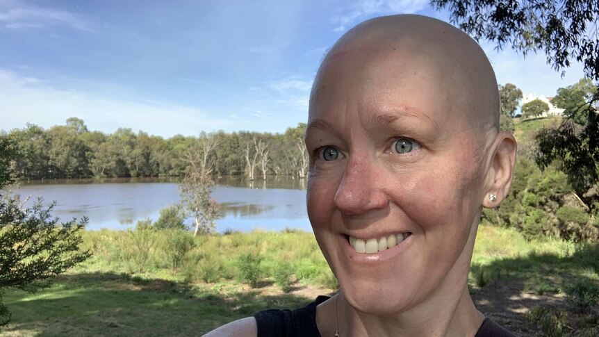 Jo Woods stands smiling in front of green trees and a river. She has grey eyes and a bald head.