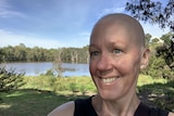 Jo Woods stands smiling in front of green trees and a river. She has grey eyes and a bald head.