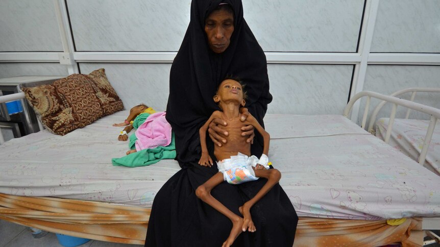Salem Abdullah Musabih, 6, is held by his mother as she sits on a bed at a malnutrition intensive care unit in Hodaida, Yemen.