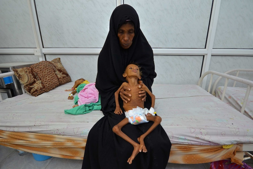 Salem Abdullah Musabih, 6, is held by his mother as she sits on a bed at a malnutrition intensive care unit in Hodaida, Yemen.