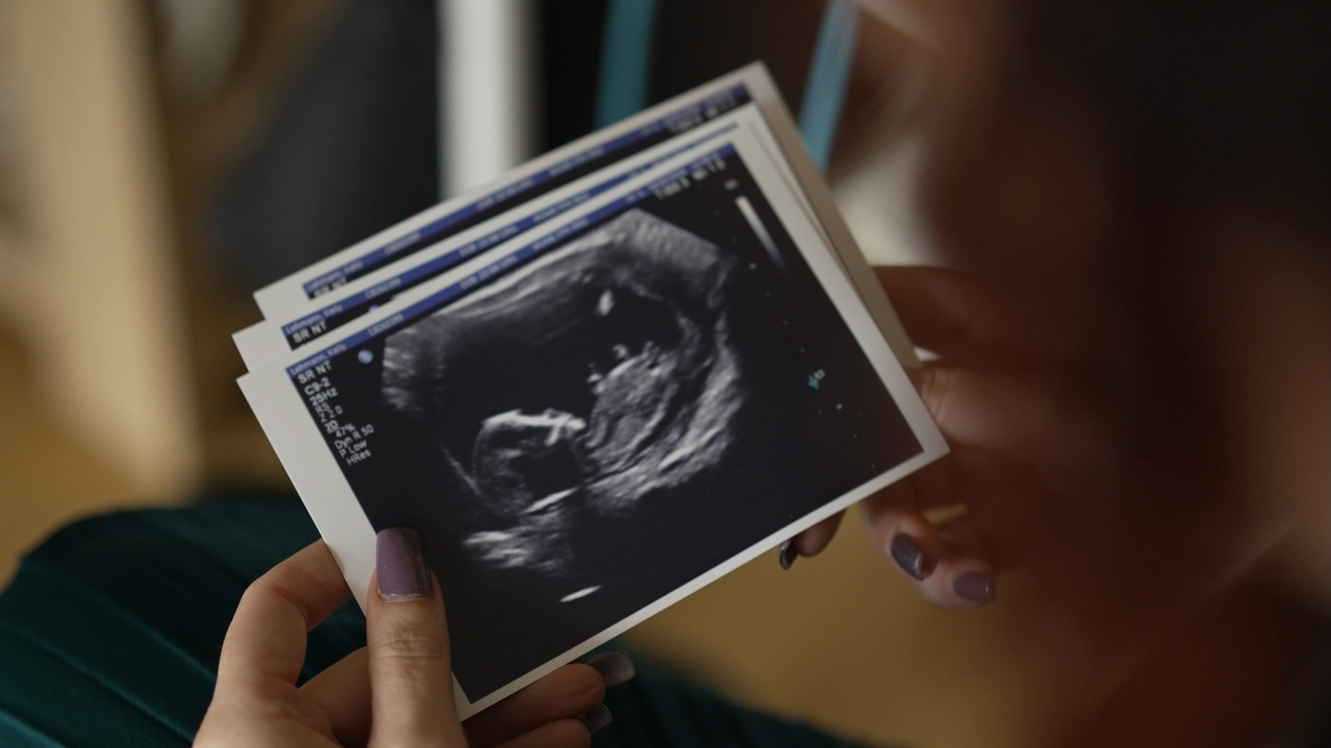 A woman holding ultrasound pictures of her baby in her hands.