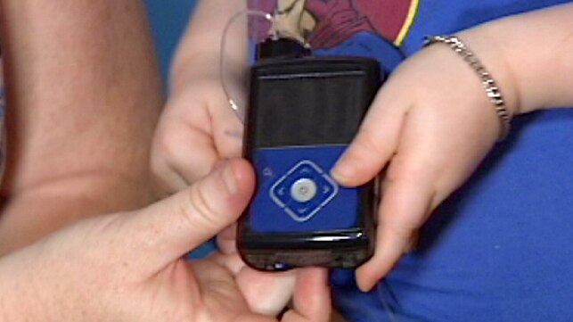 Artificial pancreas-pump device fitted to WA boy Xavier Hames 21 January 2014