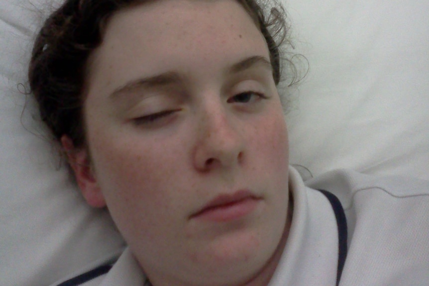 A young girl lies in a hospital bed. She has her right eye shut