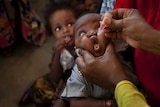 Somali baby gets his face squeezed as he receives a polio vaccine at the Medina Maternal Child Health centre in Mogadishu.