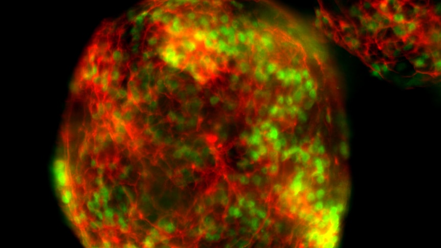 Mouse embryonic stem cells, genetically engineered using CRISPR to glow under the microscope