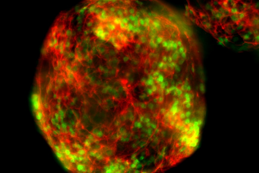 Mouse embryonic stem cells, genetically engineered using CRISPR to glow under the microscope