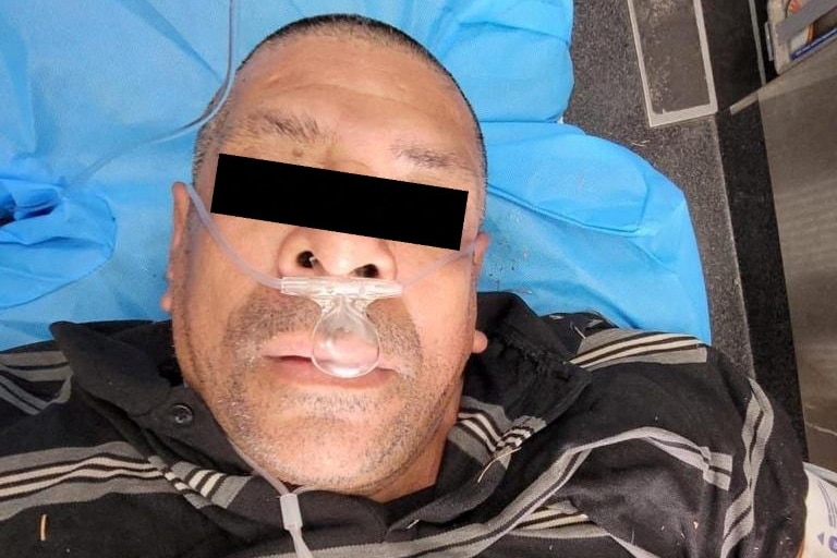 A photo of a man lying on a blue fabric, with around his face and in his nose. His eyes are blacked out and not visible.