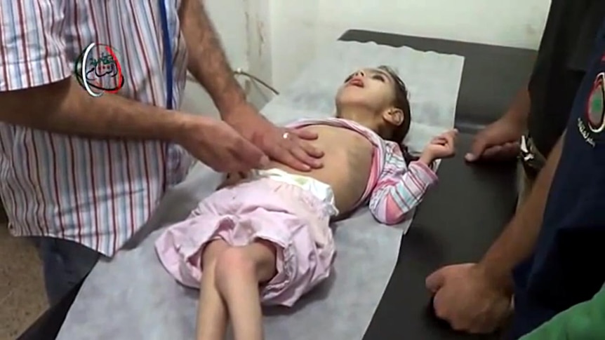 A malnourished Syrian child lies on a table in a clinic.