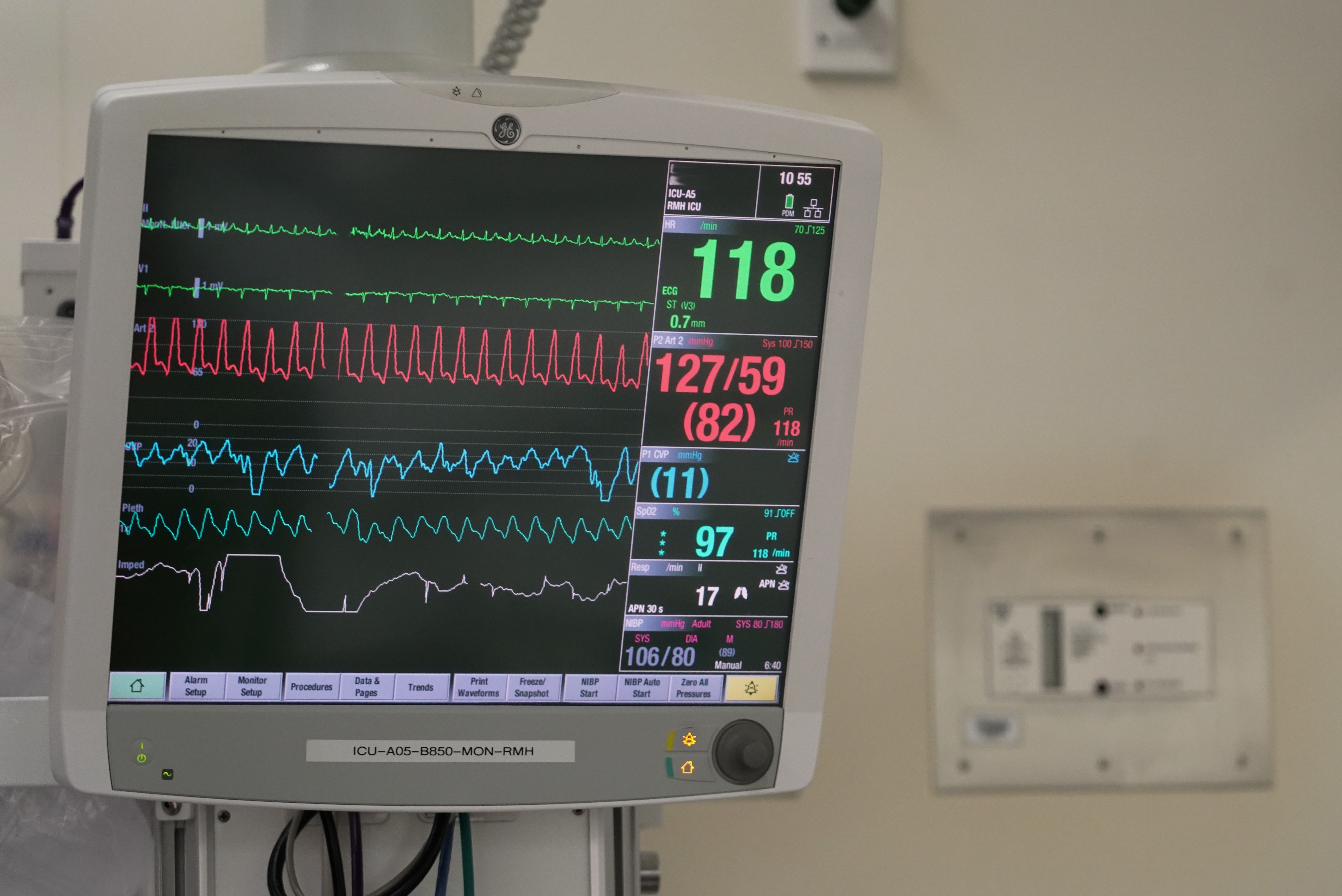 Patients being treated at the Royal Melbourne Hospital road trauma unit.