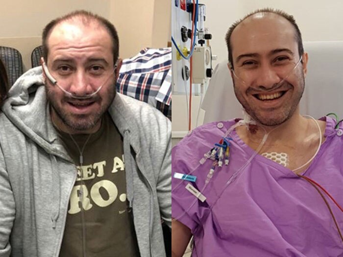 Composite photo of Double-lung transplant patient Jordan Trieger before and after surgery